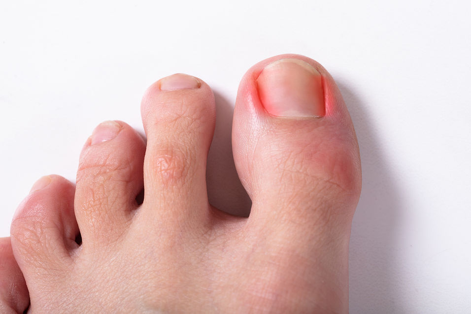 2. How to Tell if Your Toe Nail Color is a Sign of Poor Health - wide 9